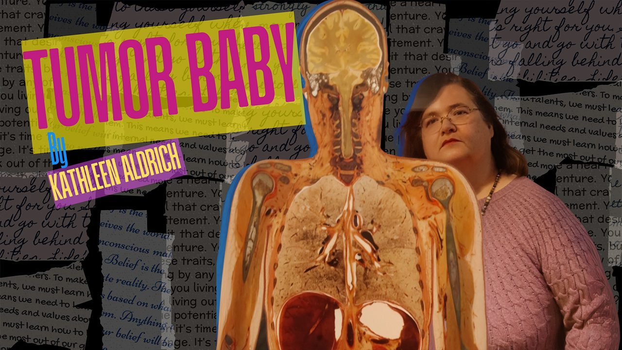 Tumor Baby